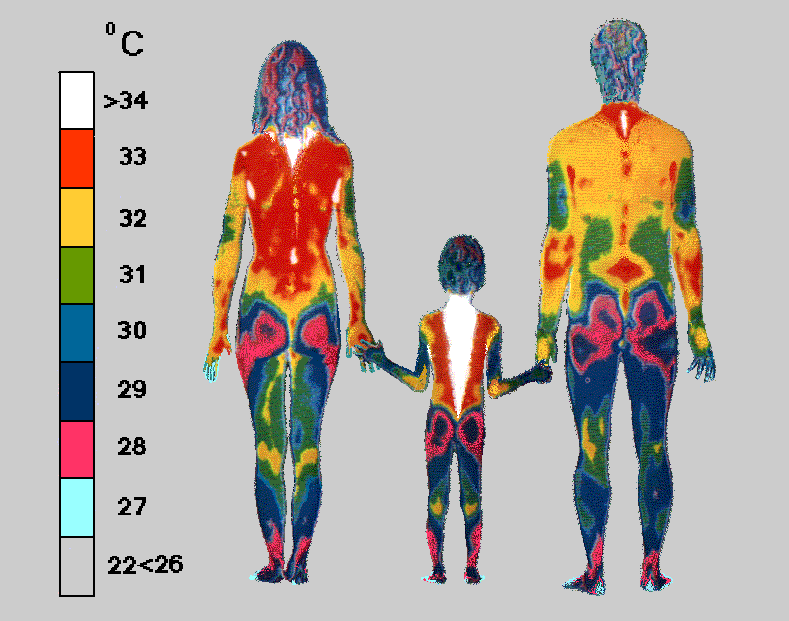 Thermogram shown is a temperature sensitive picture, taken without clothes in a 22C room show that a healthy Child generates internal spinal warmth along the full length of his/her spine - The thermogram shown is a temperature sensitive image, with colours showing temperatures in 1C steps: Grey (cool), Turquoise, Purple, Pink, Blue, Green, Yellow, Orange, White (warm)... Where Grey (cool) is 22-26C or cooler and White (warm) is 34C or warmer
